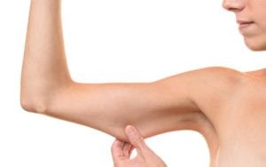 Picture of what brachioplasty looks like