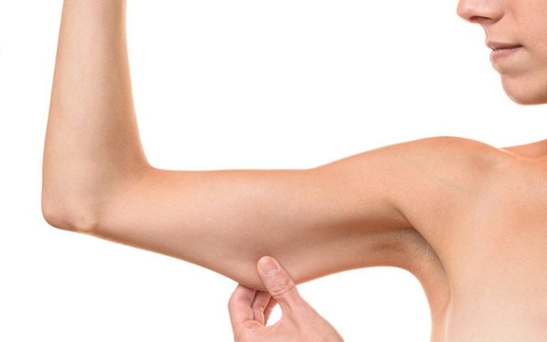 Picture of what brachioplasty looks like